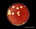 streptococcus pyogenes